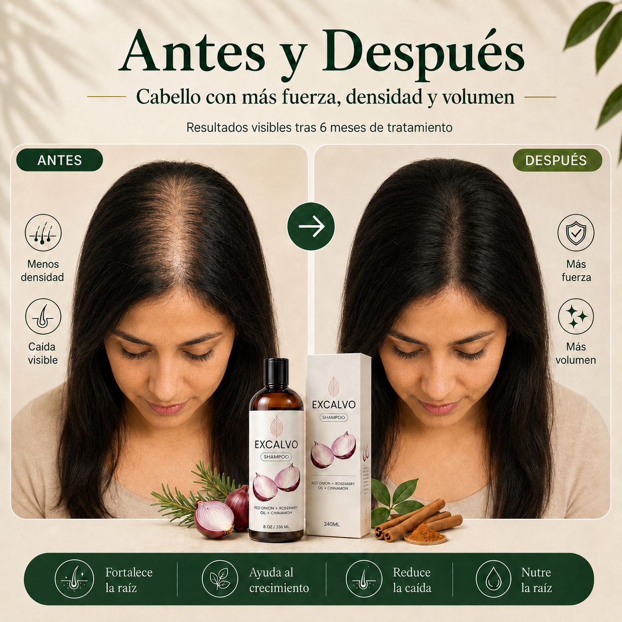 Frena la caída desde la raíz con Excalvo Shampoo USA